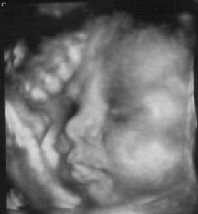 Our chubby little one