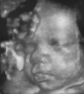 Stay in there and get big!